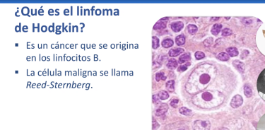 El linforma de Hodgkin se caracteriza por un crecimiento anormal de las células, las cuales crecen sin control, y el sistema es incapaz de eliminarlas