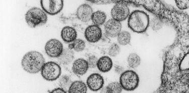El hantavirus no es un virus nuevo, ni originado en China
