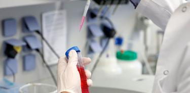 Rusia espera sacar la primera vacuna anti-COVID antes de octubre
