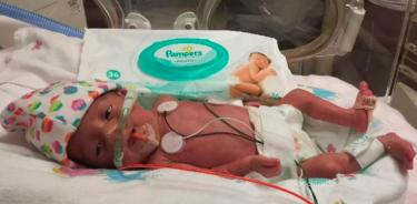 Buscan crear conciencia sobre separación de bebés prematuros y sus padres en hospitales