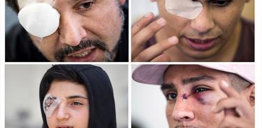 Van 197 chilenos con  lesiones oculares  en disturbios