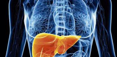 Alerta por alza de casos de hígado graso y cirrosis hepática en jóvenes