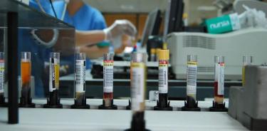 Laboratorio ruso con muestras de viruela y ébola registra explosión