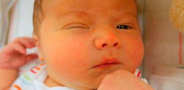 Mucho ojo, con los ojitos de los bebés, requieren observación y  cuidados