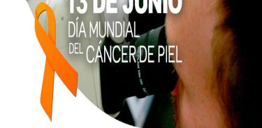 Al año se diagnostican 16 mil nuevos casos de cáncer de piel en México