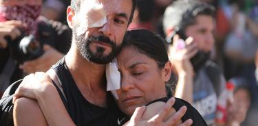 Ya son 352 las personas con heridas oculares en Chile