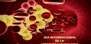 Hipercolesterolemia familiar, enfermedad asociada a altos niveles de colesterol en sangre
