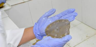 Elaboran “curitas” para pie diabético con colágeno obtenido de medusas