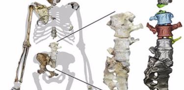 Nuevos fósiles revelan que sediba trepa a los árboles aunque caminase como un humano.
