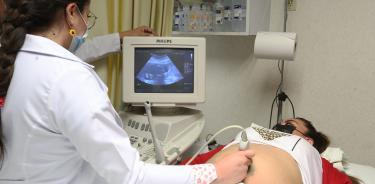 La concepción después de los 35 años, conlleva el riesgo de tener un bebé con síndrome de down, por lo que, es recomendable planear embarazos entre los 25 y 35 años