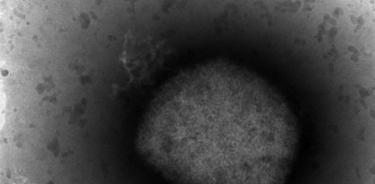 Imagen microscópica del virus causante de la viruela del mono, cuya secuenciación completa han logrado investigadores del Instituto de Salud Carlos III. Fotografía cedida por el Instituto de Salud Carlos III.