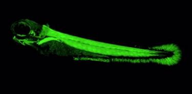 En esta imagen, una proteína verde fluorescente se enciende solo en el músculo del tronco en un embrión de pez cebra en desarrollo.