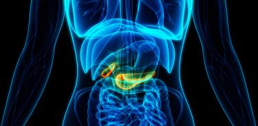 En México, el adenocarcinoma ductal pancreático representa la decimosegunda causa de cáncer.