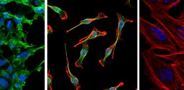 TDP permite tomar imágenes de estructuras celulares con alta resolución. A. Células HEK-293, citoesqueleto de actina marcado en verde con faloidina. B. Células SHY-5Y, citoesqueleto de actina marcado en rojo con faloidina y citoesqueleto de tubulina inmunomarcado en verde. C. Células HeLa, citoesqueleto de actina marcado en rojo con faloidina, En A, B y C los núcleos son teñidos con DAPI, en azul.