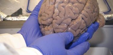 : Además de tener más de 60 años investigando neurociencias, Cinvestav también creó el primer Banco Nacional de Cerebros, para investigación.