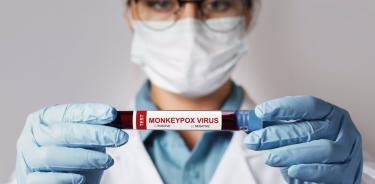 Un prueba para detectar la viruela del mono.