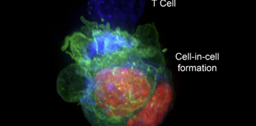 Una proyección tridimensional de células tumorales organizadas en formación de célula en célula, con los núcleos de las células, codificados por colores en rojo, y la membrana, en verde, siendo atacada por una célula T, en azul.