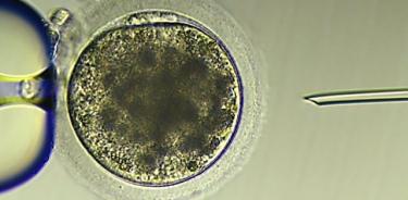 Un óvulo de burra inmediatamente antes de una inyección intracitoplasmática de espermatozoides.