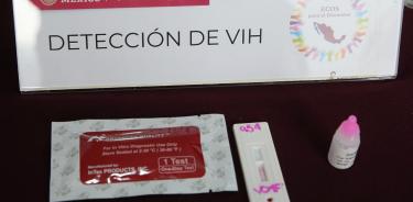 El ISSSTE, resaltó que la Clinica San Fernando, de la Ciudad de México, brinda atención integral a sus derechohabientes con VIH, o Sida, a fin de que controlen la enfermedad y logren llevar una vida prácticamente normal
