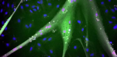 Células madre bovinas inmortalizadas diferenciadas con proteínas musculares totalmente expresadas (azul = núcleos; magenta = miogenina; verde = miosina). Escala aprox 1 mm.