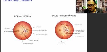 Ismael Bárcenas, explicó que la retinopatía diabética puede ser identificada a través de la identificación de un conjunto de señales eléctricas.