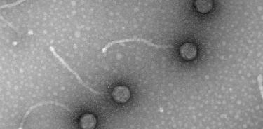 Micrografías de fagos, virus de bacterias, obtenidas en el laboratorio de Virología Ambiental y Biomédica del Instituto de Biología Integrativa de Sistemas (UV-CSIC).