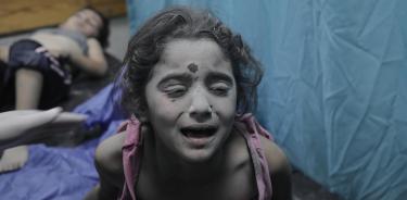 Niños heridos tras el ataque israelí al hospital de Gaza