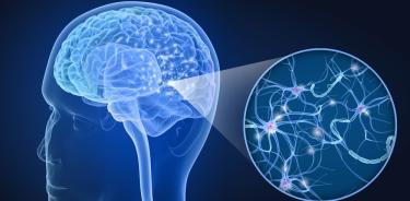 La esclerosis múltiple es una enfermedad autoinmune que afecta el sistema nervioso central