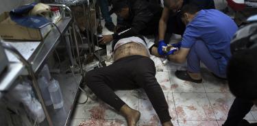 Un palestino herido es atendido en el suelo de un hospital de Jan Yunis, en el sur de la Franja, tras un bombardeo israelí
