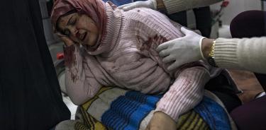 Una mujer herida en el hospital Nasser de Khan Yunis, en el sur de la Franja de Gaza