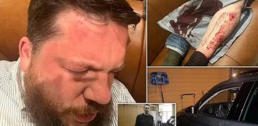 Combo del ataque a martillazos que sufrió el colaborador de Navalni en Riga, Lituania
