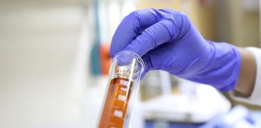 El Centro de Investigación Biomédica del Sur (CIBIS) del IMSS ha generado 38 solicitudes de patentes que se han ingresado al IMPI y ya cuenta con 28 patentes que protegen los usos de los medicamentos