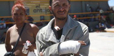 El migrante venezolano Carlos Meza muestra su mano lesionada, mientras permanece con su familia en un campamento improvisado en Chihuahua
