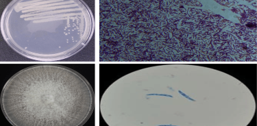 Microbios aislados de árboles de aguacate. arriba a la izquierda, colonias bacterianas, a la derecha, tinción de sus células, abajo a la izquierda, colonia de un hongo patógeno, a la derecha, tinción de sus esporas.